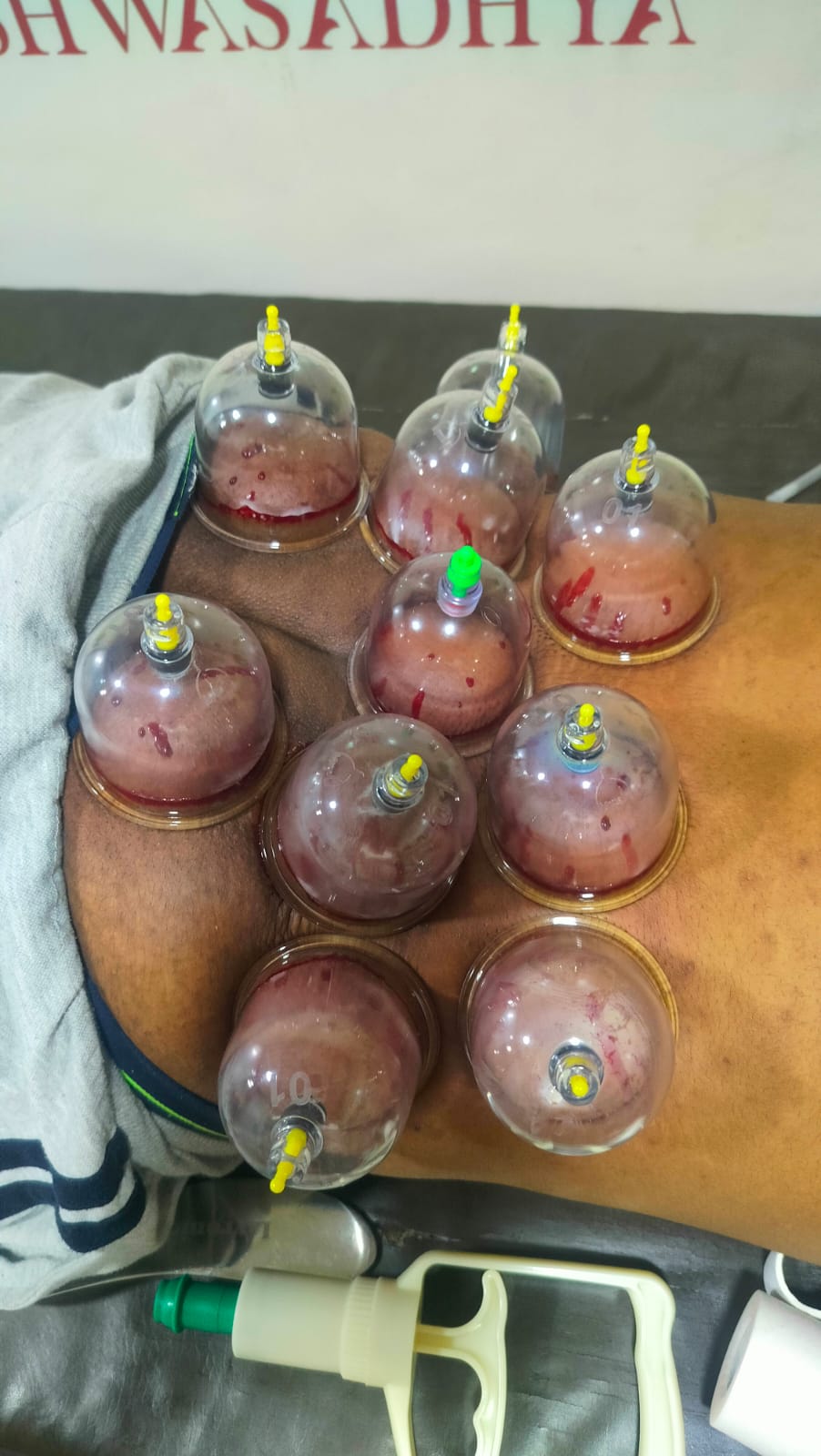 Dr. Mansi's physiotherapy work