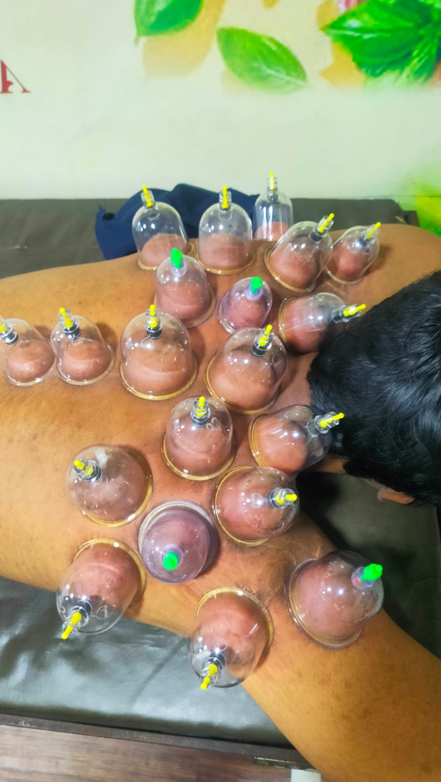 Dr. Mansi's physiotherapy work